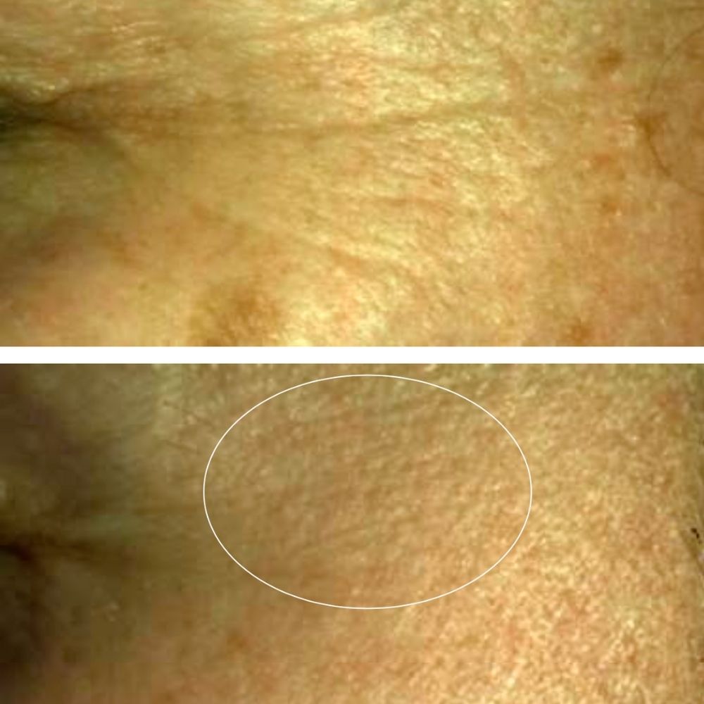 Sérum Anti-Âge Intense [NOUVEAUTÉ]